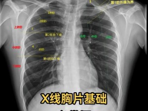 我想要看胸片曝光，为什么医院不给我看？