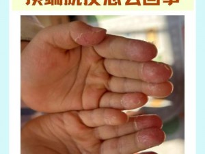 一根手指头疼为什么-如何-怎样回事？手指疼痛的原因和解决办法