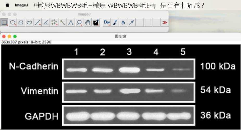 撒尿WBWBWB毛—撒尿 WBWBWB 毛时，是否有刺痛感？