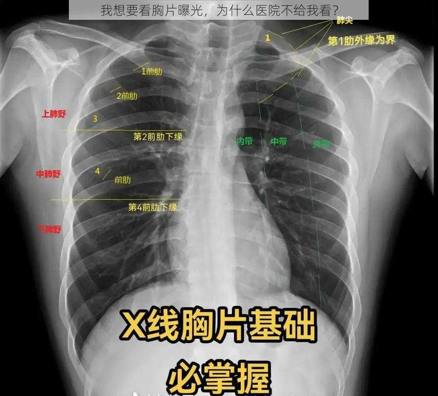 我想要看胸片曝光，为什么医院不给我看？