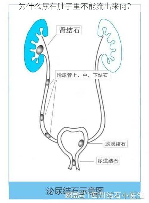 为什么尿在肚子里不能流出来肉？