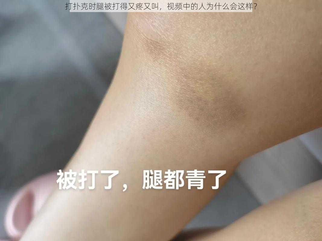 打扑克时腿被打得又疼又叫，视频中的人为什么会这样？